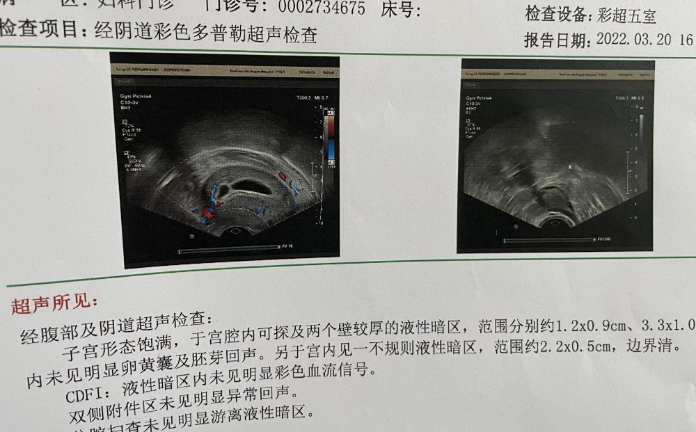 空囊一般会持续生长多久呢？看完就明白了